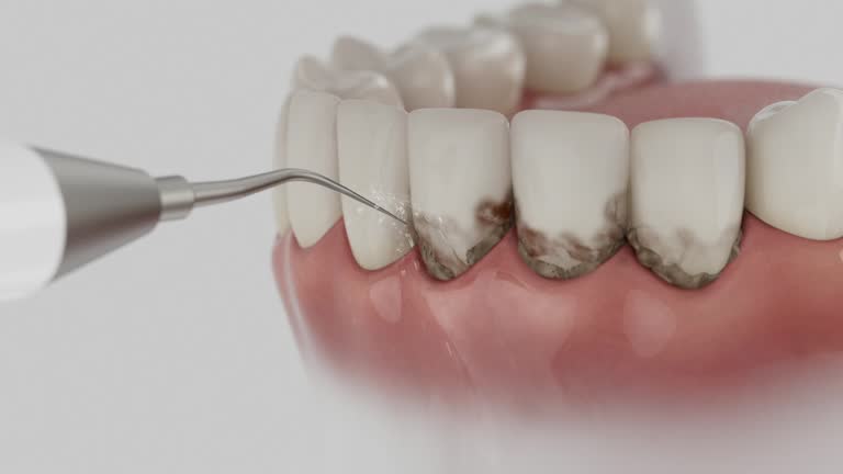 Trusted Tooth Extraction service in Somerville, TN - Dentist Open Now